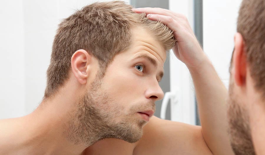 How to Stop Hair Loss Causes Naturally