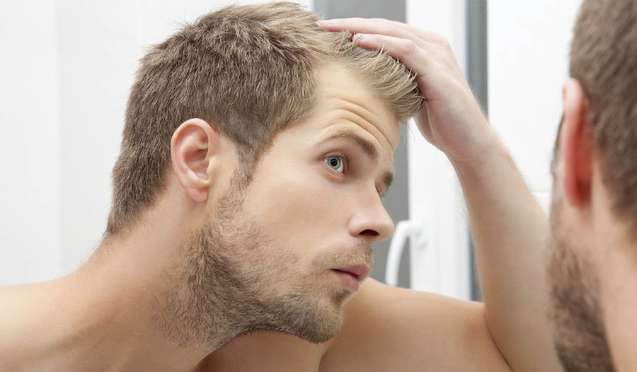 How to stop balding naturally increase