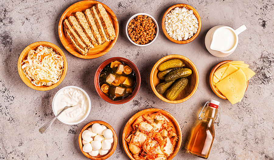 Table of fermented foods like kimchi, pickles, kombucha, yogurt